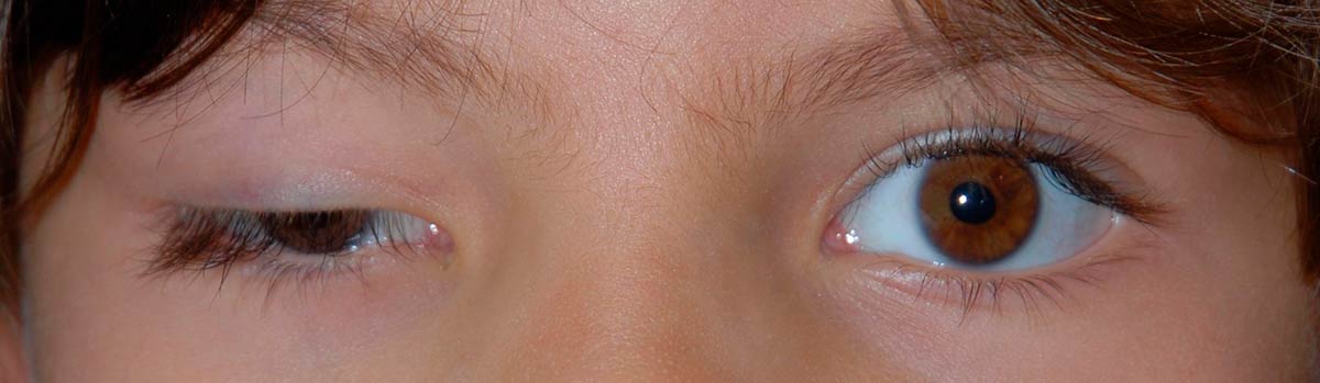 Заболевания глаз и методы лечения