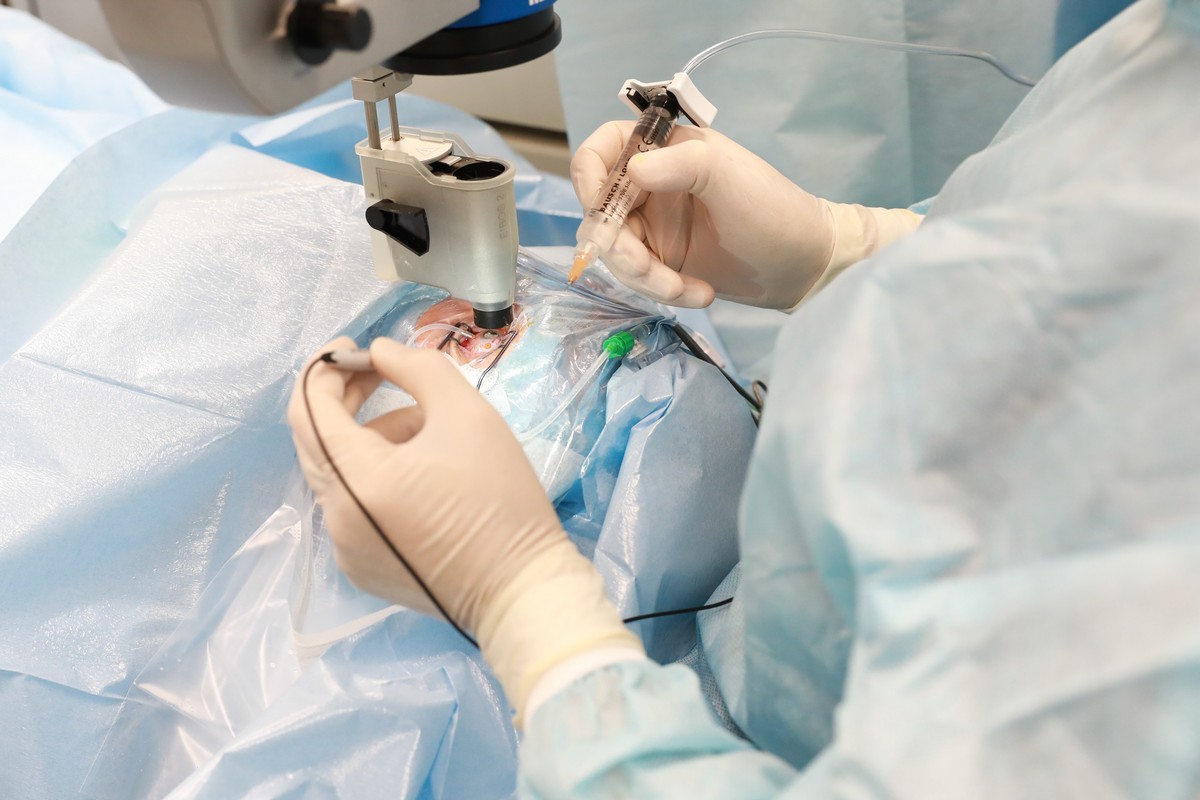 Факоэмульсификация катаракты. Операция по катаракте по омс. Катаракта операция квота. Рекомендации после операции по замене хрусталика. Мнтк микрохирургия глаза федорова новосибирск.