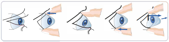 ночные линзы как снять