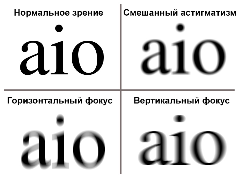 Астигматизм