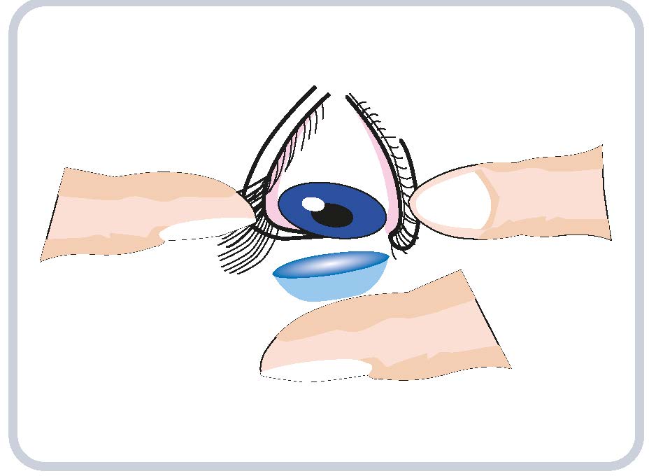 одеть ночные линзы
