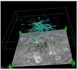 SOLIX ОСТ глаза