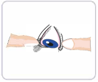 одевание ночных линз