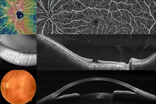 Оптический когерентный томограф SOLIX 