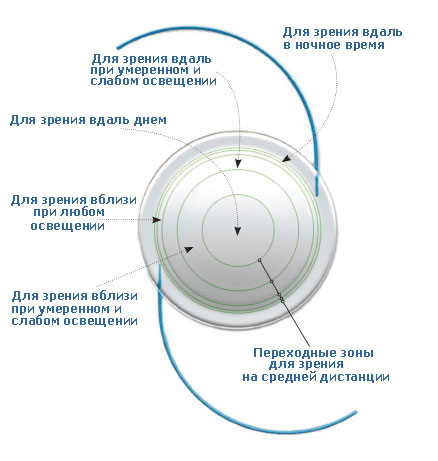 Мультифокальная ИОЛ Мультифокальная ИОЛ