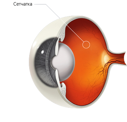 Сетчатка глаза лечение