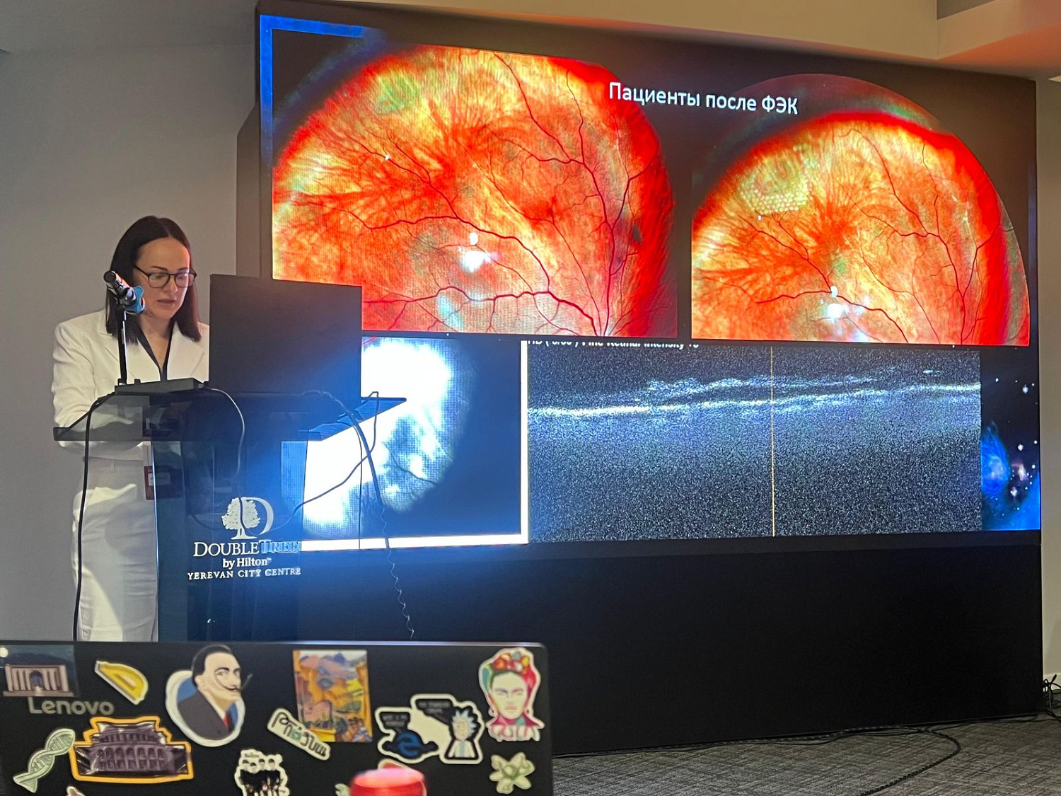 Врачи клиники Офтальмологической клиники СПЕКТР приняли участие в VII Armenian International Ophthalmological Conference