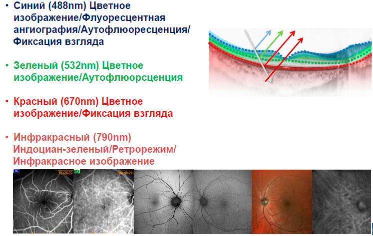 лечение сетчатки лечение сетчатки